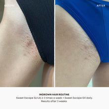 Load image into Gallery viewer, Sweet Escape Scented Ingrown Treatment Oil