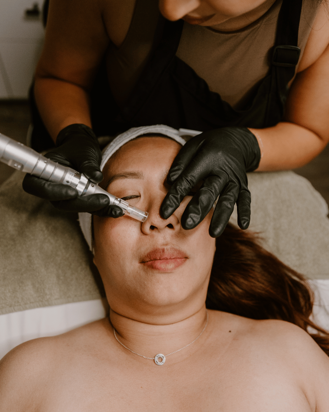 Why We Choose Microneedling Over Heat-Based Treatments - Every Time