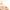 What is Microneedling?